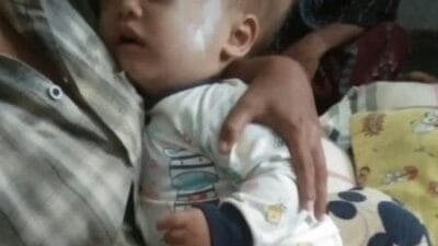 Seorang Balita Berusia 13 Bulan Penderita Penyakit Sidrosifalus Asal Gumukus Butuh Bantuan