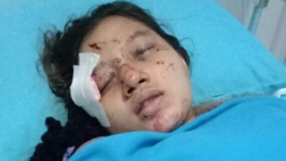 Ditabrak KA, Wakil Ketua DPRD Medan Kawal Penanganan Korban