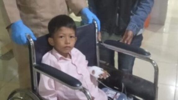 Kapolda Sumut Bantu Pengobatan Anak Penderita Tumor