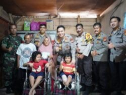 Kapolda Riau Bantu Pengobatan Dua Bocah Penderita Rapuh Tulang
