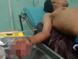 Kawanan Begal di Deli Serdang Bacok Tangan Korban Hingga Nyaris Putus