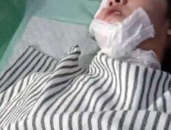 Pelaku Penyiram Air Keras ke Mama Muda Berhasil Diringkus