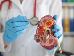 Penyakit Gagal Ginjal Bisa Diketahui Melalui Warna Urine