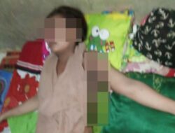 Cemburu Buta Bikin Gelap Mata, Sekdes Tega Bakar Kekasihnya