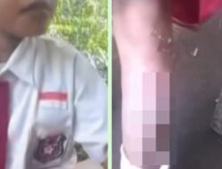 Tante di Jember Tega Siram Ponakan Pakai Kuah Bakso Panas