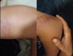 Diduga Curi TBS, Tiga Warga “Disiksa” Oknum Keamanan PT SIR