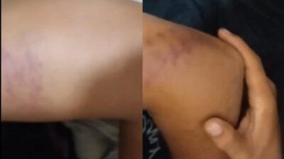 Diduga Curi TBS, Tiga Warga “Disiksa” Oknum Keamanan PT SIR