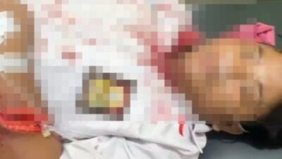 Pelajar SMA di Binjai Diserang Begal, Sejumlah Tubuh Disabet Sajam